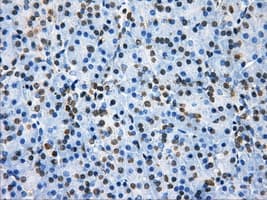 HDAC10 Antibody (clone OTI3C2)