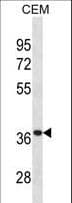 Polyclonal Rabbit anti-Human TTPA Antibody (aa82-108, WB)