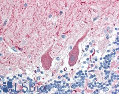 MT-ND6 Antibody (aa72-86)