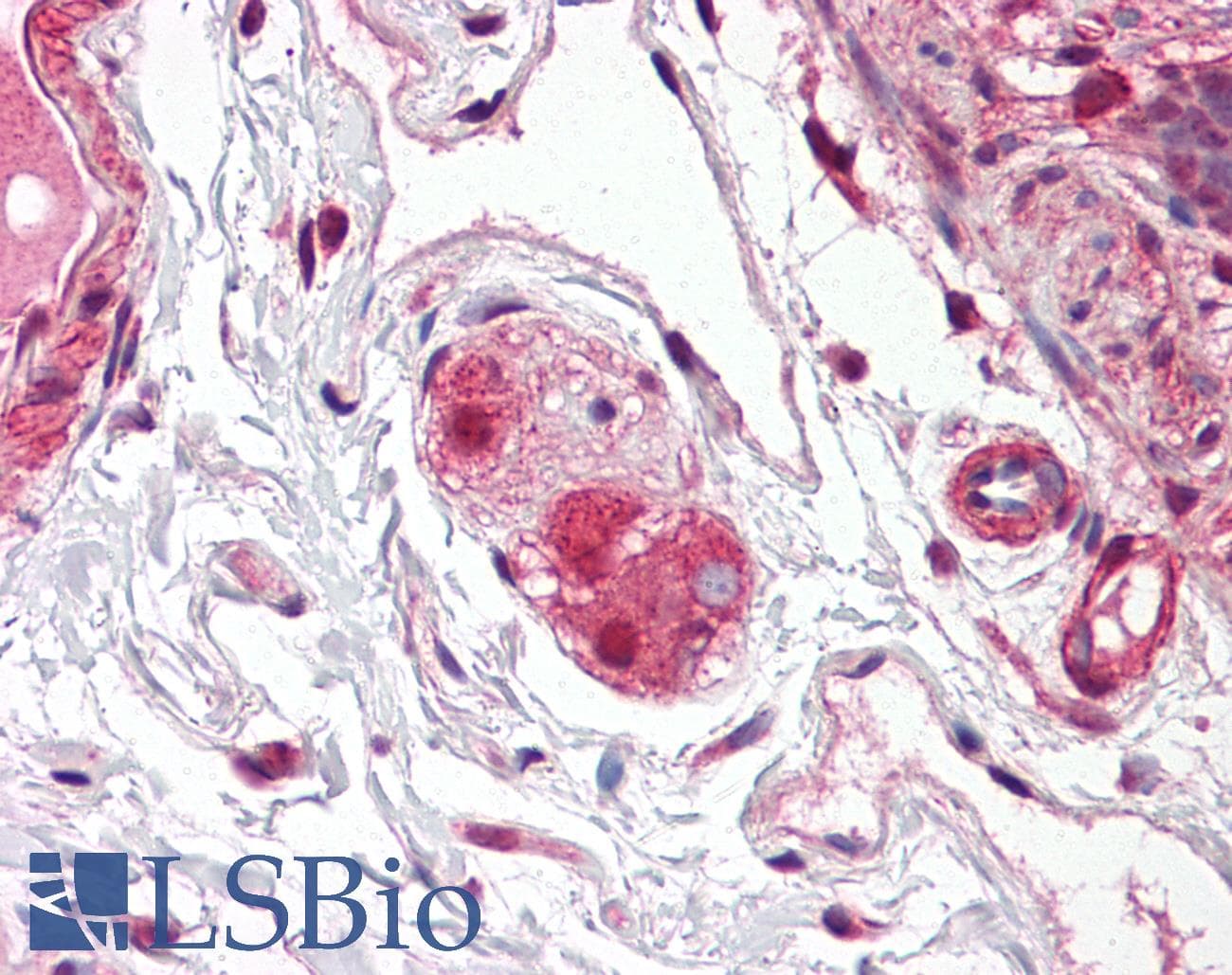 PathPlus™ GLUL / Glutamine Synthetase Antibody