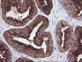 CD1C Antibody (clone OTI1H9)