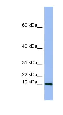 SEMG1 Antibody (aa251-300)