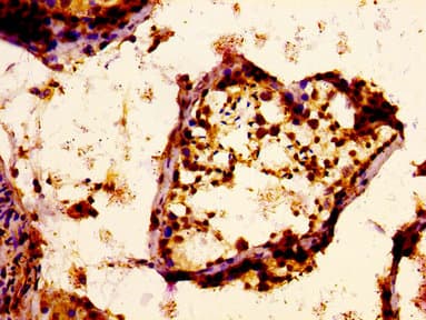 Polyclonal Rabbit anti-Human PACE4 / PCSK6 Antibody (IHC)