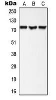 AKAP10 Antibody (N-Terminus)