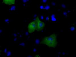 BTK Antibody (clone OTI12H4)