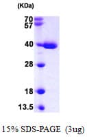 Human TRP32 / TXNL1 Protein (Recombinant His)