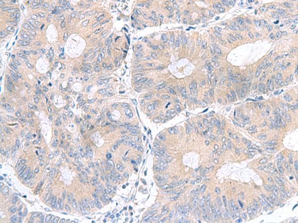 UBE2F Antibody