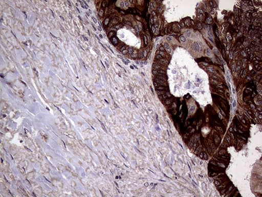 AGR2 Antibody (aa21-175, clone OTI5E10)