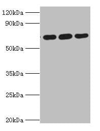 IHC-plus™ Polyclonal Rabbit anti-Human ATAD3A Antibody (aa1-240, IHC, WB)