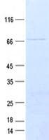 Human ABHD4 Protein (Recombinant GST, N-terminus + His, C-terminus)