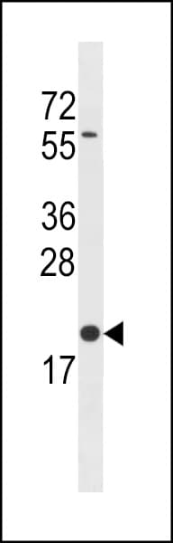 BLOC1S3 Antibody (aa176-202)