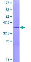Human EDEM3 Protein (Recombinant GST)