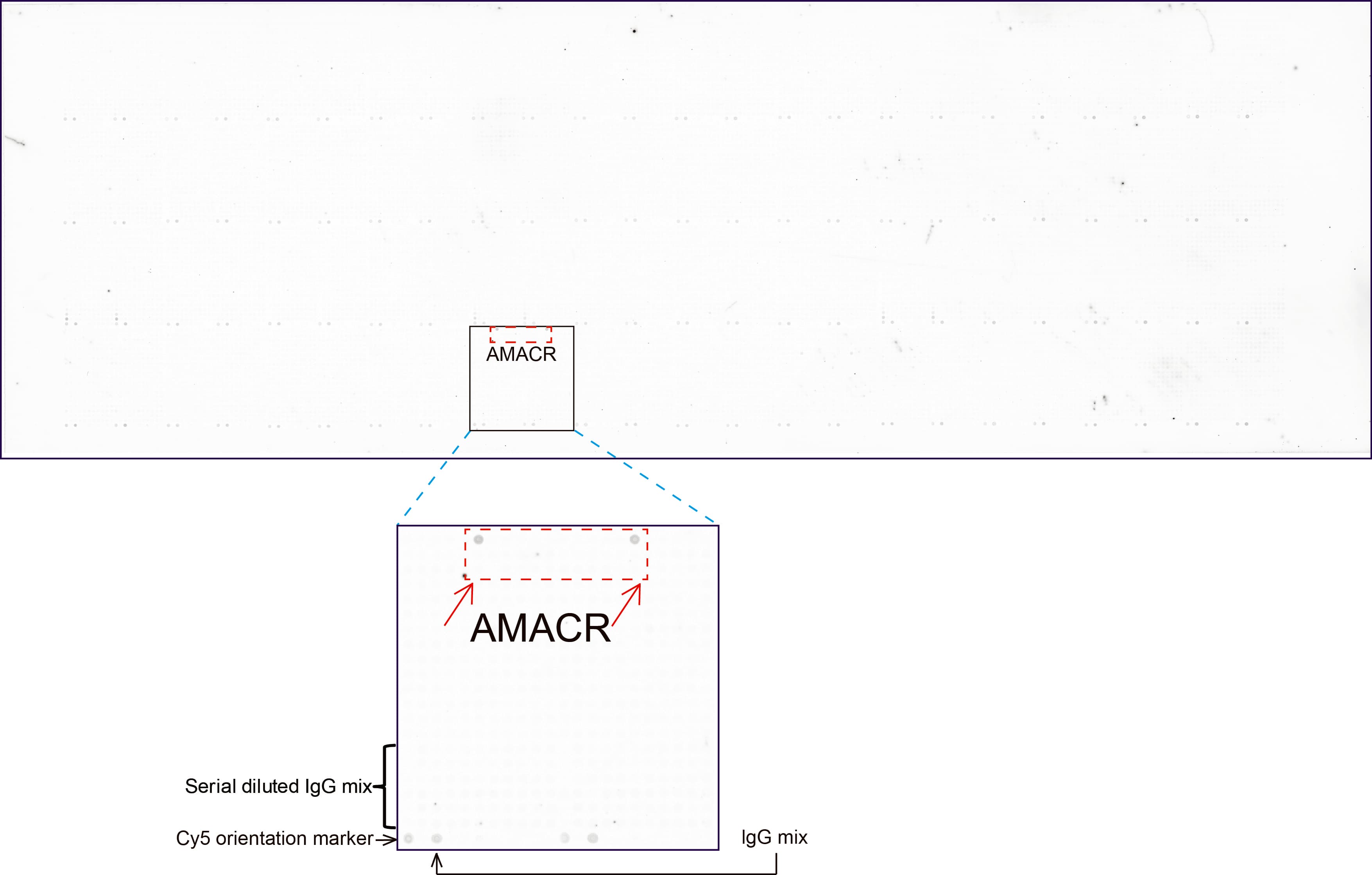 AMACR / P504S Antibody (clone UMAB214)