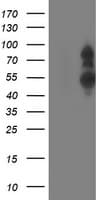PHF21B Antibody (clone OTI4C5)
