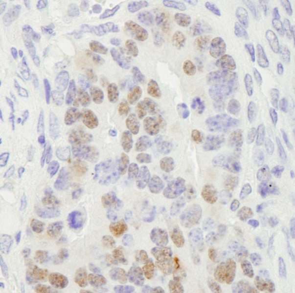RCC2 Antibody (aa475-C-term)