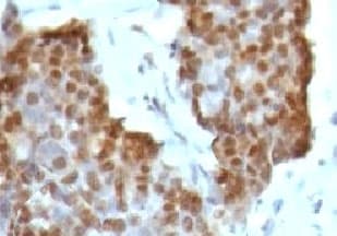 ESR2 / ER Beta Antibody (C-Terminus, clone NR3Gb-1)