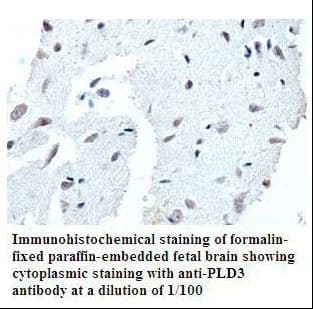PLD3 / Phospholipase D3 Antibody (aa162-439)