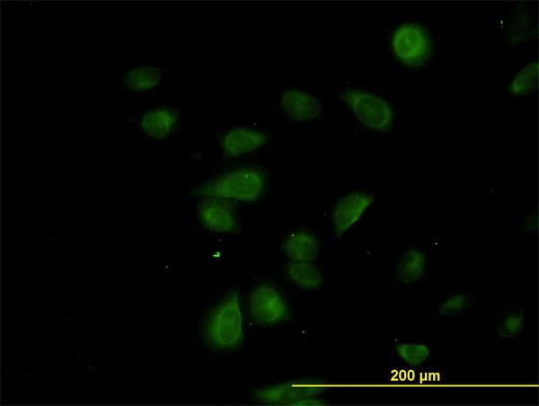CDK5RAP3 Antibody (clone 1G4)
