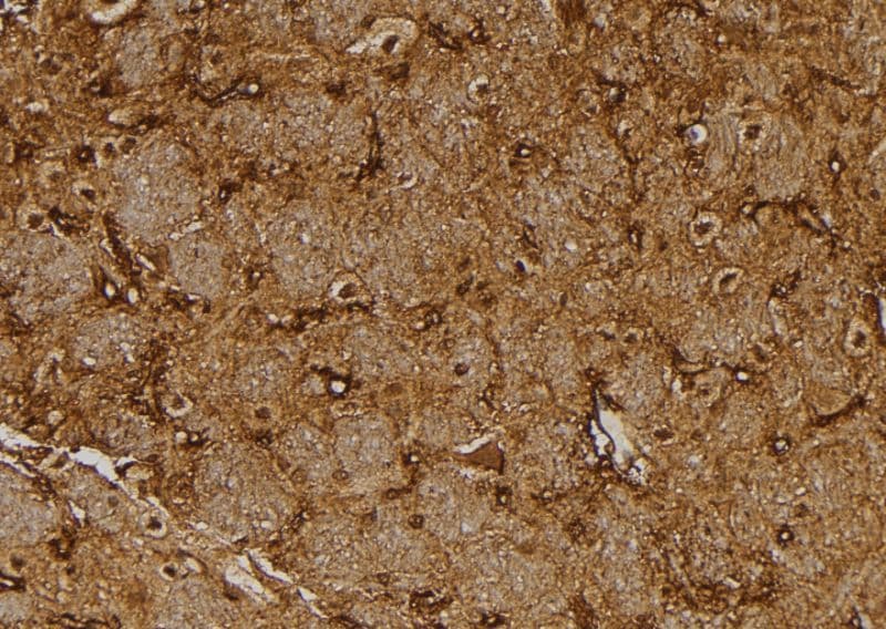 NUTF2 / PP15 Antibody