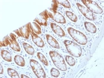 CTNNB1 / Beta Catenin Antibody (clone CTNNB1/1509)