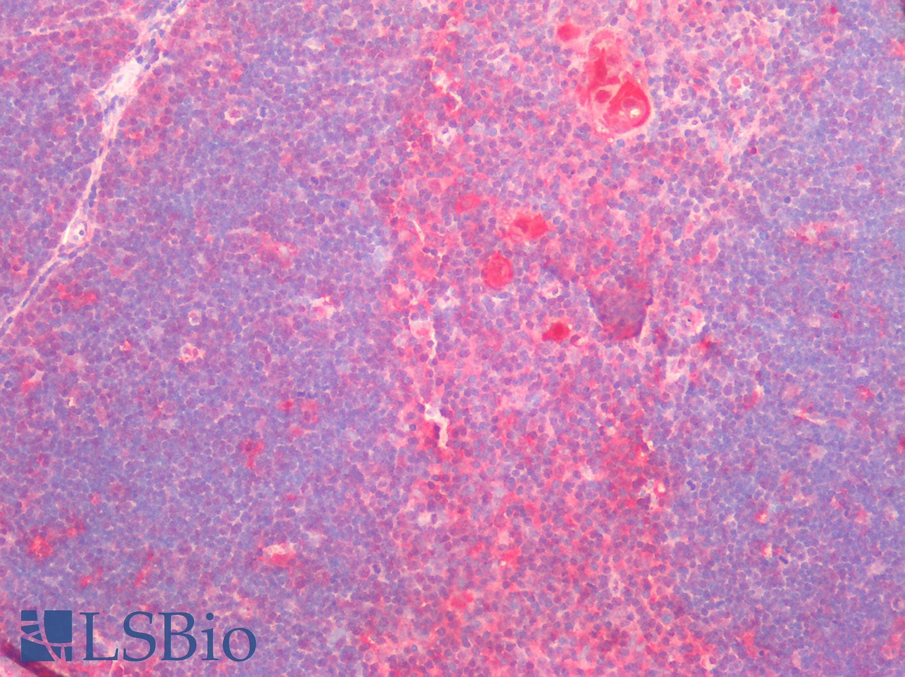 IHC-plus™ Polyclonal Rabbit anti-Human BCL2L1 / BCL-XL Antibody (aa46-66, IHC, WB)