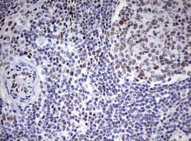 CD5 Antibody (clone OTI10F4)