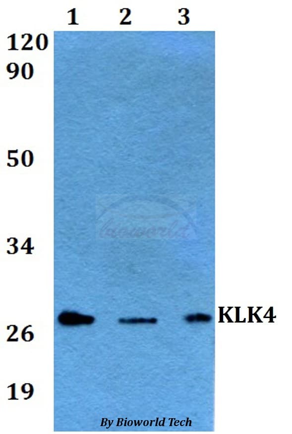 Polyclonal Rabbit anti-Human KLK4 / Kallikrein 4 Antibody (WB)