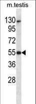 IHC-plus™ DAPK3 / ZIP Kinase Antibody (aa255-282)