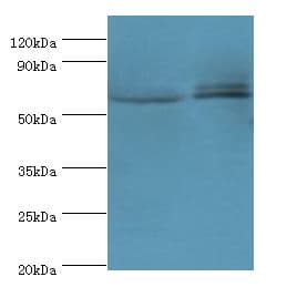 Polyclonal Rabbit anti-Human CREB3L2 / BBF2H7 Antibody (aa1-247, IHC, WB)