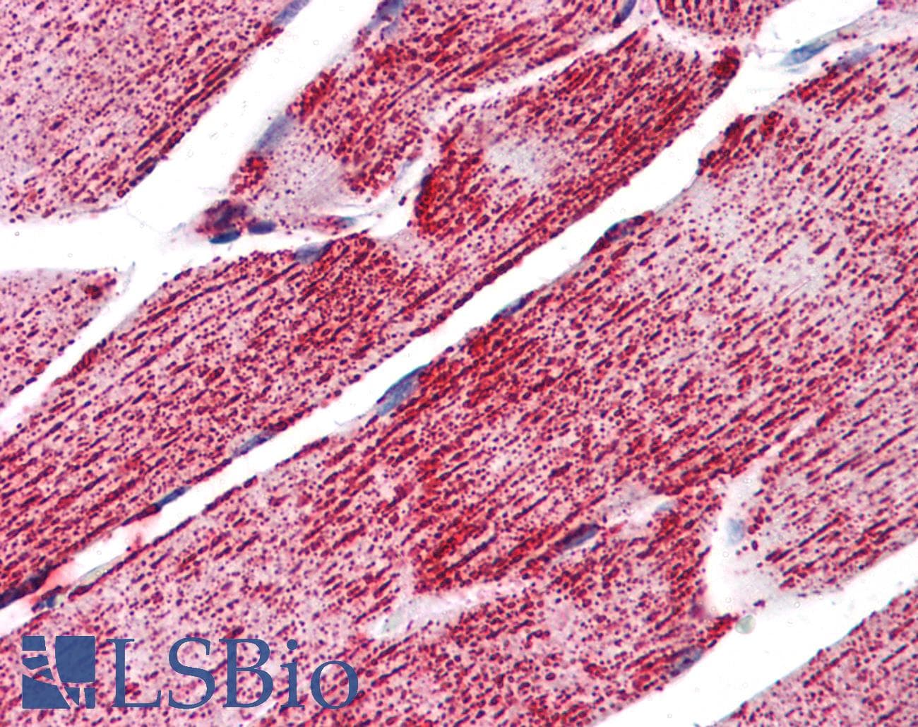 PathPlus™ HSPA9 / Mortalin / GRP75 Antibody (C-Terminus)