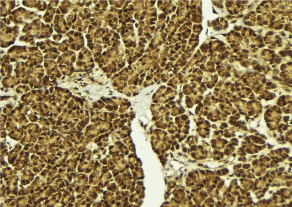 Polyclonal Rabbit anti-Human POU5F2 Antibody (IHC, WB)