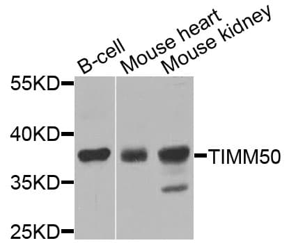 TIMM50 Antibody