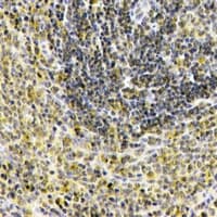 IL1F10 Antibody (aa113-152)