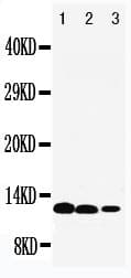 Polyclonal Rabbit anti-Human IL13 Antibody (aa135-146, WB)