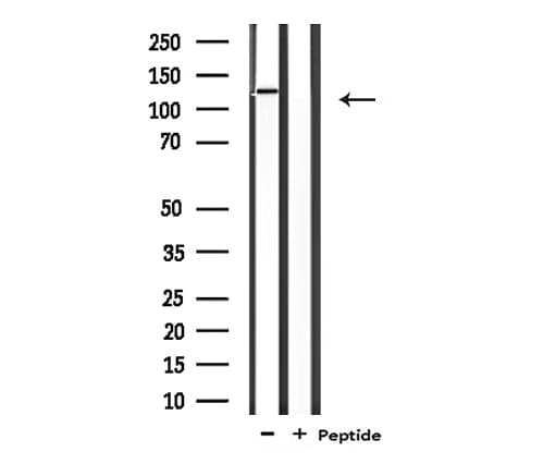CARD6 Antibody