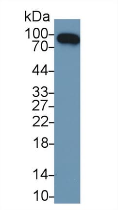 Polyclonal Rabbit anti-Rat CFB / Complement Factor B Antibody (PE, aa34-159, WB)