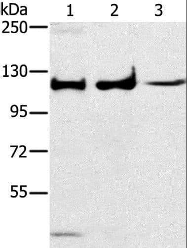 Polyclonal Rabbit anti-Human MAPK7 / ERK5 Antibody (IHC, WB)