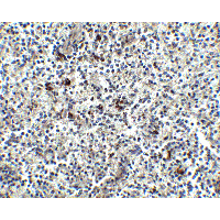 Polyclonal Rabbit anti-Human LY96 / MD2 / MD-2 Antibody (IHC, IF, WB)
