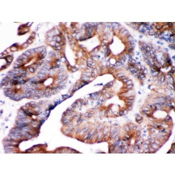 SPTLC1 / HSN1 Antibody (aa444-473)