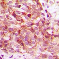 CDK15 / ALS2CR7 Antibody (Internal)
