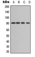 PRKCA / PKC-Alpha Antibody (C-Terminus)