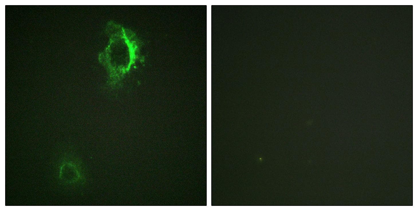 Polyclonal Rabbit anti-Human CD5 Antibody (phospho-Tyr453, IF, WB)
