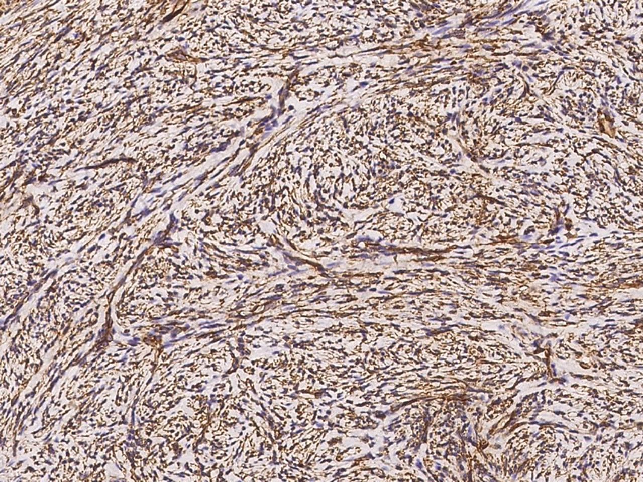 HSPB1 / HSP27 Antibody (Preservative Free)