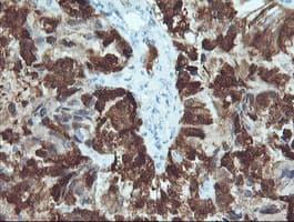 CRABP2 Antibody (clone OTI10D6, Carrier-free)