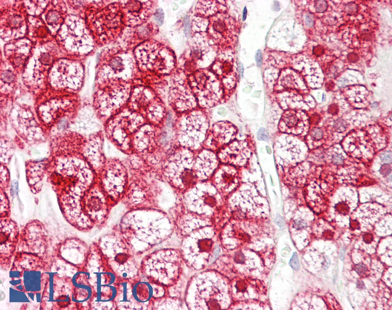 IHC-plus™ SLC16A12 / MCT12 Antibody (aa115-164)