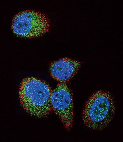 HRAS / H-Ras Antibody (aa104-128)