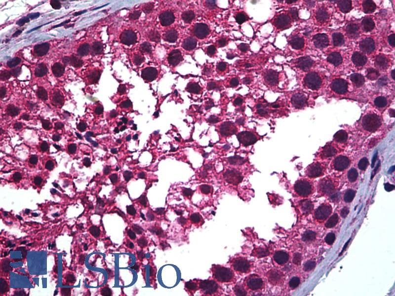 IHC-plus™ Monoclonal Mouse anti-Human RARA / RAR Alpha Antibody (clone 2C9-1F8, IHC, IF, WB)