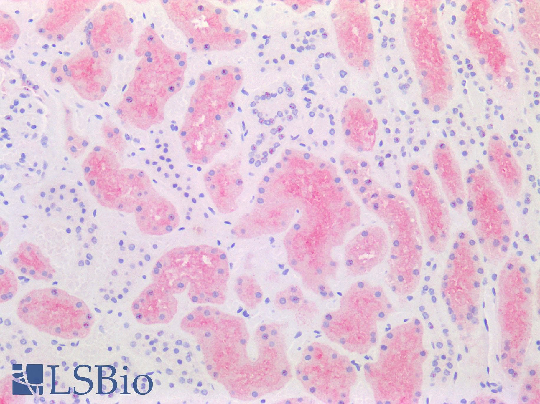 SLC6A19 Antibody (C-Terminus)