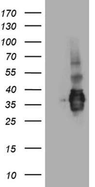 SSU72 Antibody (clone OTI2E2)