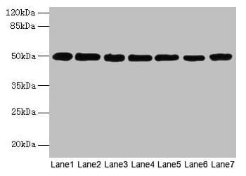 TUBB / Beta Tubulin Antibody
